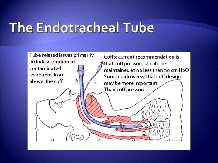 The Endotracheal Tube related issues primarily include aspiration of contaminated secretions from above the