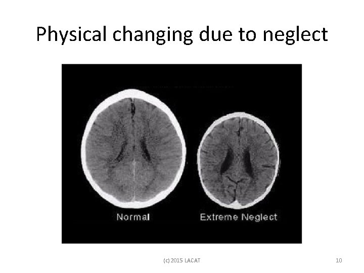 Physical changing due to neglect (c) 2015 LACAT 10 