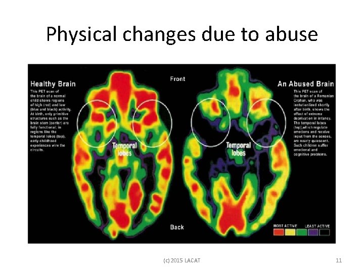 Physical changes due to abuse (c) 2015 LACAT 11 