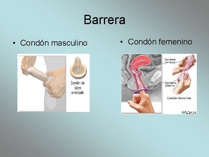 Barrera • Condón masculino • Condón femenino 