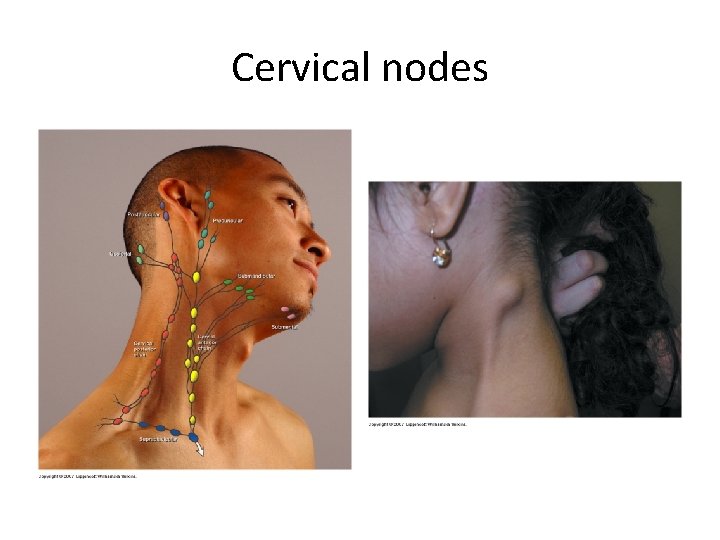 Cervical nodes 