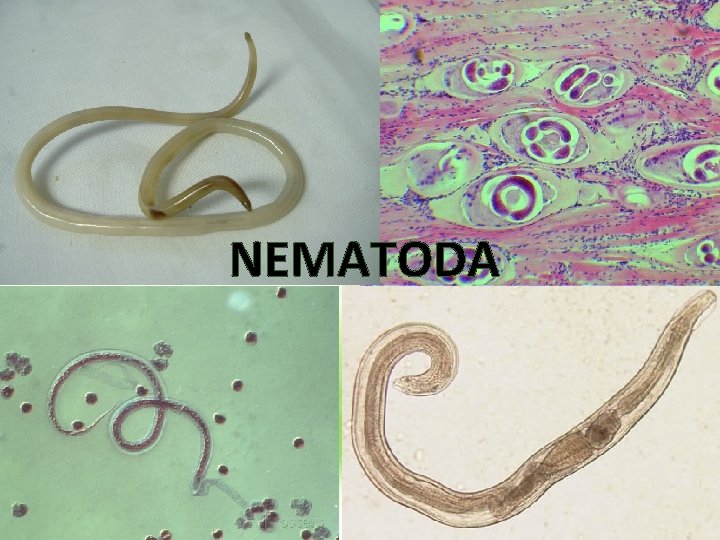 NEMATODA 