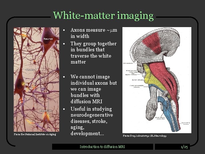 White-matter imaging • • From the National Institute on Aging Axons measure ~ m