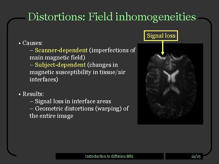 Distortions: Field inhomogeneities Signal loss • Causes: – Scanner-dependent (imperfections of main magnetic field)