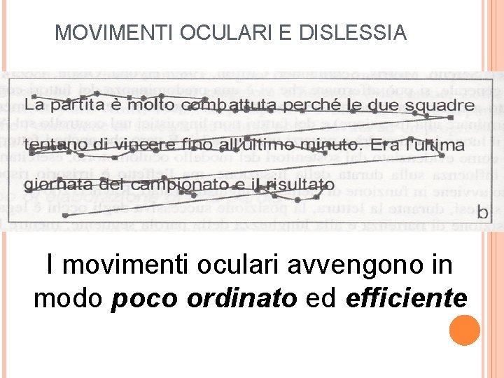 MOVIMENTI OCULARI E DISLESSIA . I movimenti oculari avvengono in modo poco ordinato ed