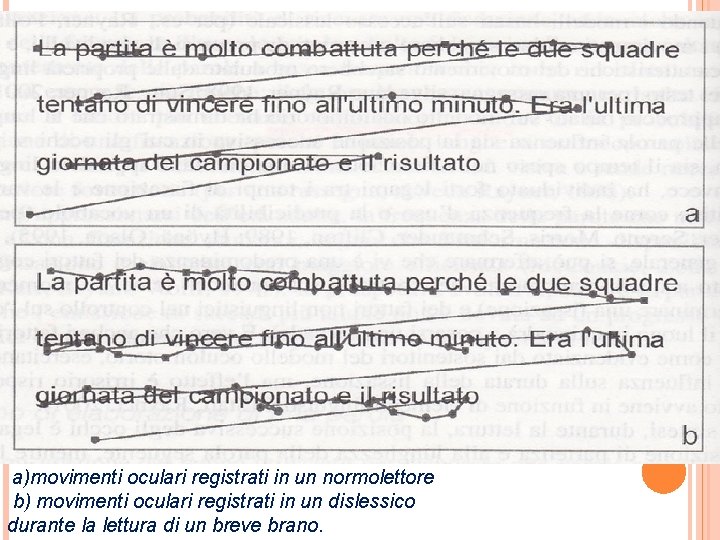  a)movimenti oculari registrati in un normolettore b) movimenti oculari registrati in un dislessico