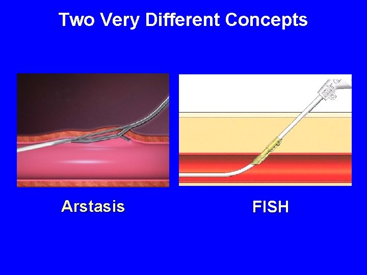 Two Very Different Concepts Arstasis FISH 