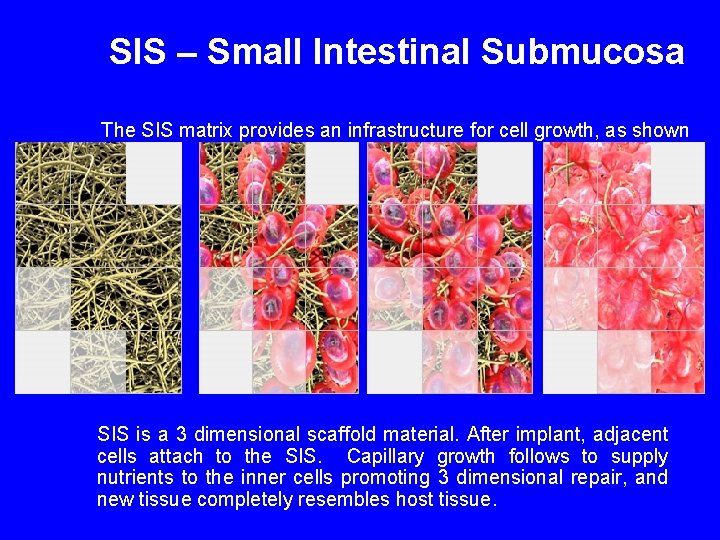 SIS – Small Intestinal Submucosa The SIS matrix provides an infrastructure for cell growth,