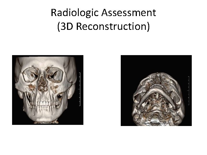 Radiologic Assessment (3 D Reconstruction) 