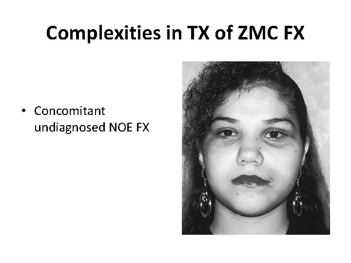 Complexities in TX of ZMC FX • Concomitant undiagnosed NOE FX 