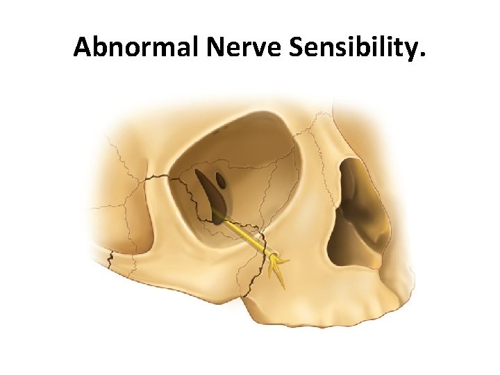 Abnormal Nerve Sensibility. 
