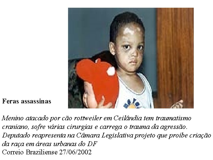 Feras assassinas Menino atacado por cão rottweiler em Ceilândia tem traumatismo craniano, sofre várias