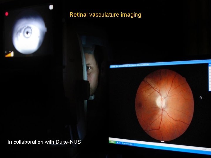 Retinal vasculature imaging In collaboration with Duke-NUS 