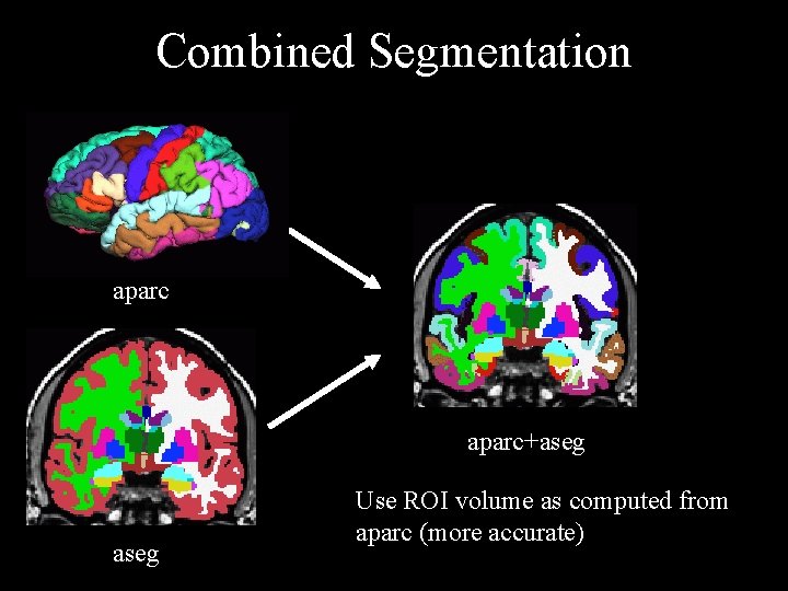 Combined Segmentation aparc+aseg Use ROI volume as computed from aparc (more accurate) 
