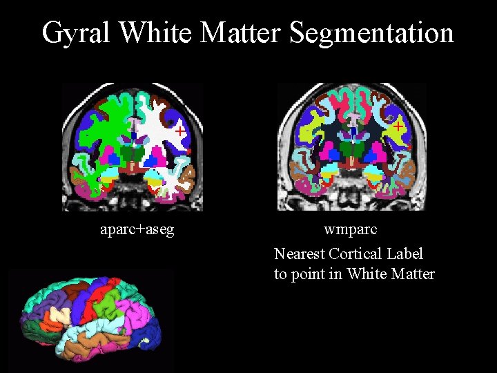 Gyral White Matter Segmentation + aparc+aseg + wmparc Nearest Cortical Label to point in
