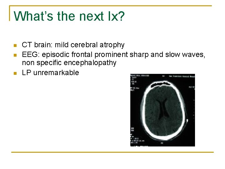 What’s the next Ix? n n n CT brain: mild cerebral atrophy EEG: episodic