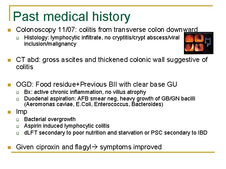 Past medical history n Colonoscopy 11/07: colitis from transverse colon downward q Histology: lymphocytic