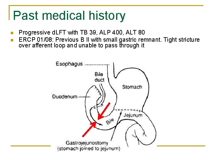 Past medical history n n Progressive d. LFT with TB 39, ALP 400, ALT