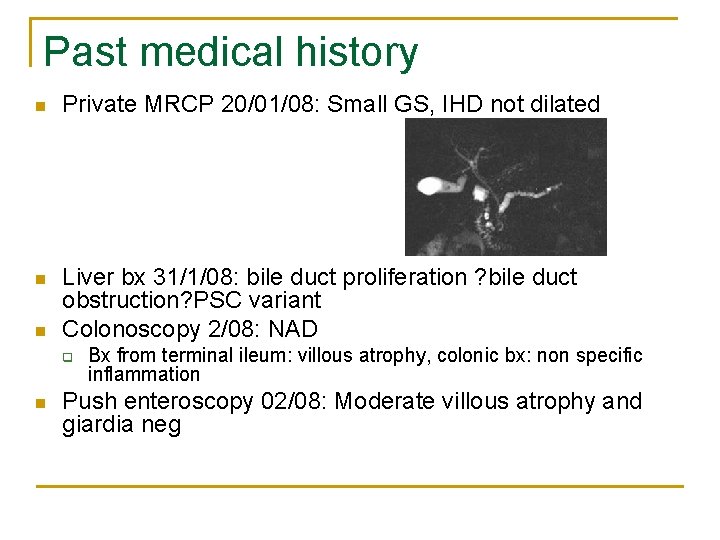 Past medical history n Private MRCP 20/01/08: Small GS, IHD not dilated n Liver