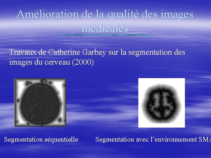 Amélioration de la qualité des images médicales Travaux de Catherine Garbay sur la segmentation