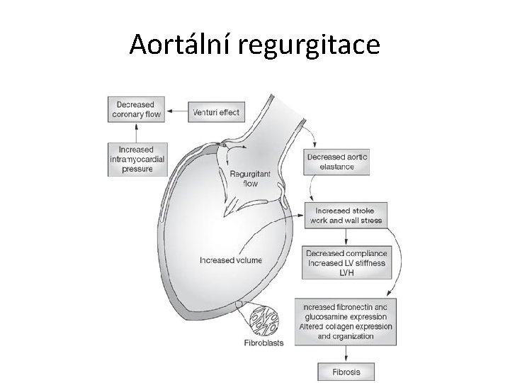 Aortální regurgitace 