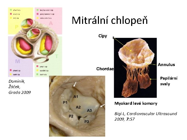 Mitrální chlopeň Cípy Papilární svaly Dominik, Žáček, Grada 2009 Myokard levé komory Bigi L,