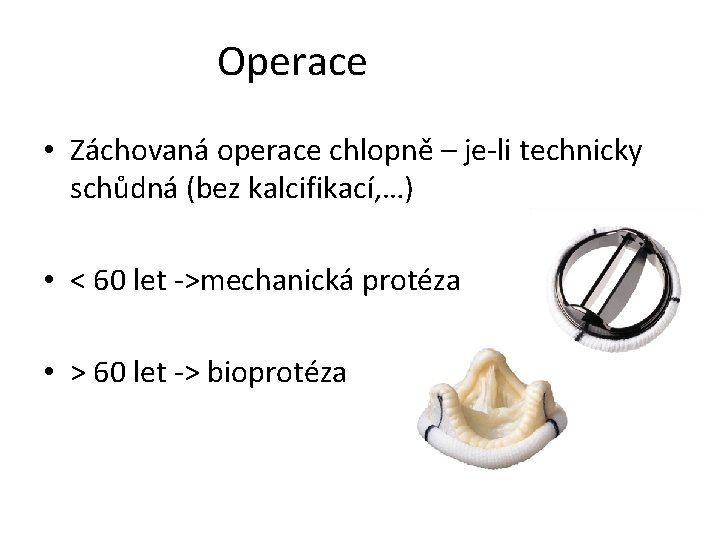 Operace • Záchovaná operace chlopně – je-li technicky schůdná (bez kalcifikací, …) • <