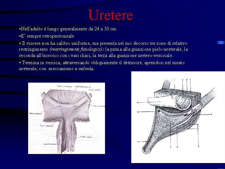 Uretere • Nell'adulto è lungo generalmente da 24 a 30 cm. • E’ sempre