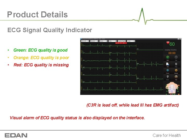 Product Details ECG Signal Quality Indicator • Green: ECG quality is good • Orange: Product Details ECG Signal Quality Indicator • Green: ECG quality is good • Orange:
