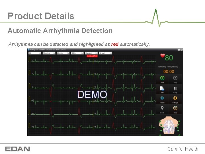 Product Details Automatic Arrhythmia Detection Arrhythmia can be detected and highlighted as red automatically. Product Details Automatic Arrhythmia Detection Arrhythmia can be detected and highlighted as red automatically.