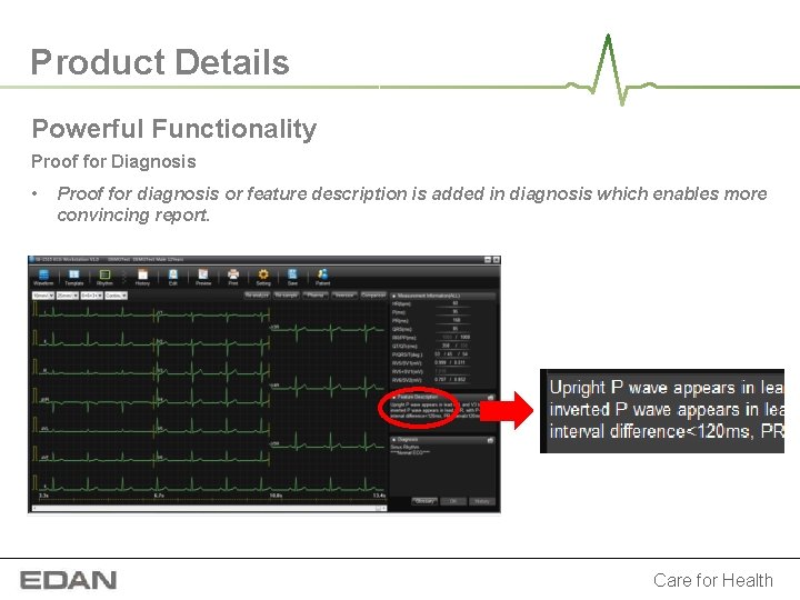 Product Details Powerful Functionality Proof for Diagnosis • Proof for diagnosis or feature description Product Details Powerful Functionality Proof for Diagnosis • Proof for diagnosis or feature description