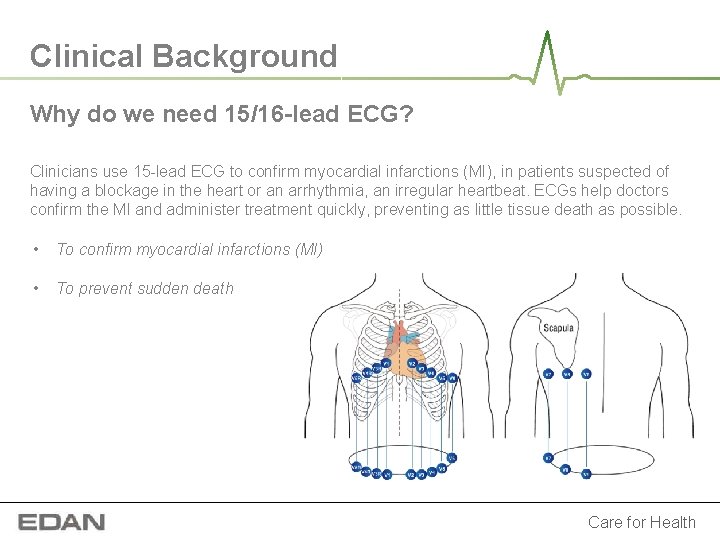 Clinical Background Why do we need 15/16 -lead ECG? Clinicians use 15 -lead ECG Clinical Background Why do we need 15/16 -lead ECG? Clinicians use 15 -lead ECG