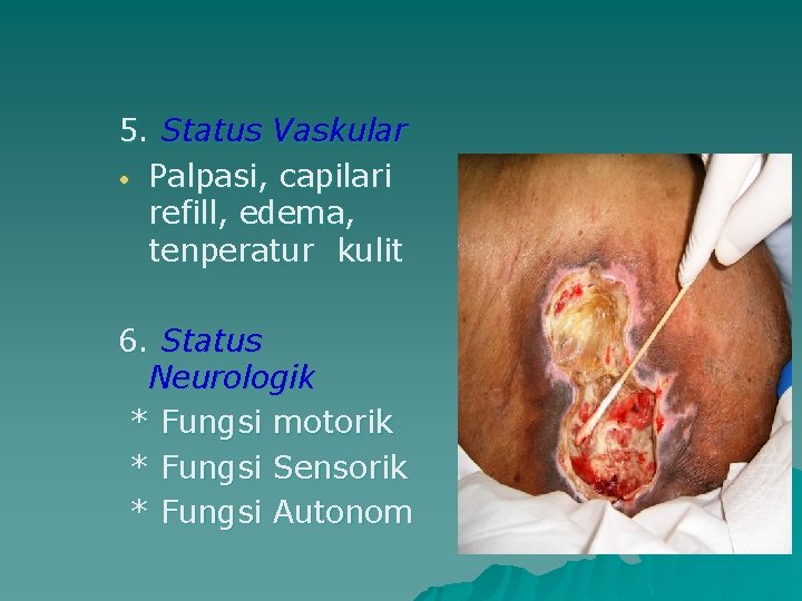 5. Status Vaskular • Palpasi, capilari refill, edema, tenperatur kulit 6. Status Neurologik *