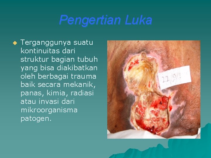 Pengertian Luka u Terganggunya suatu kontinuitas dari struktur bagian tubuh yang bisa diakibatkan oleh