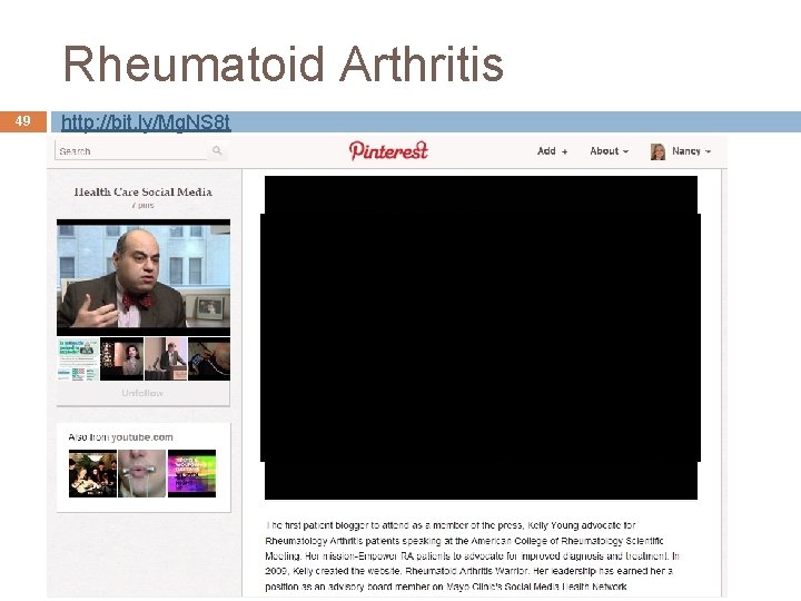 Rheumatoid Arthritis 49 http: //bit. ly/Mg. NS 8 t 