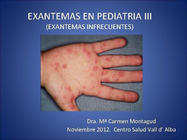 EXANTEMAS EN PEDIATRIA III (EXANTEMAS INFRECUENTES) Dra. Mª Carmen Montagud Noviembre 2012. Centro Salud