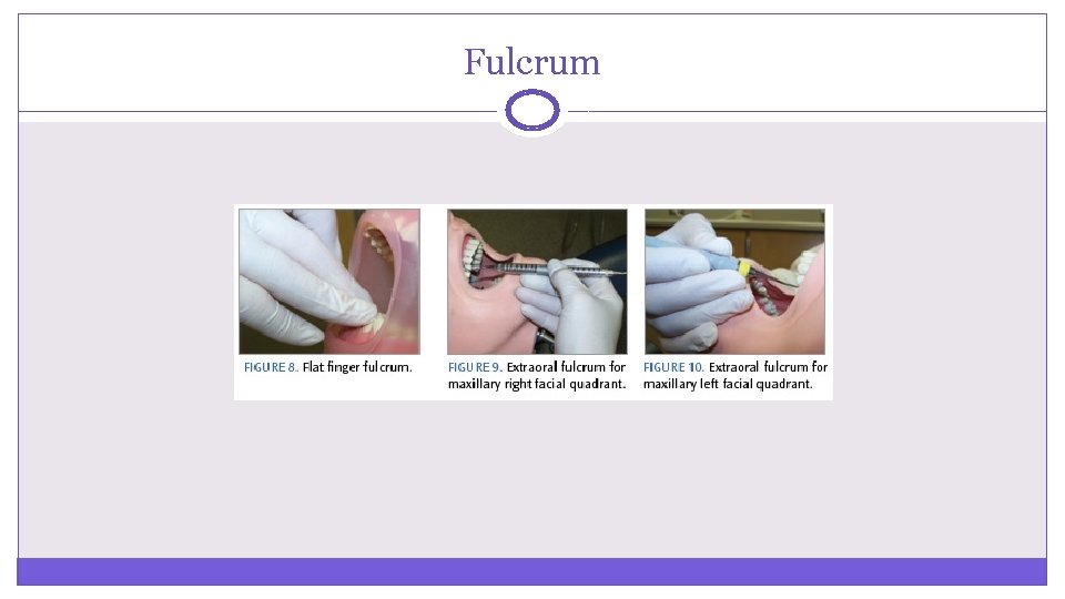 Fulcrum 