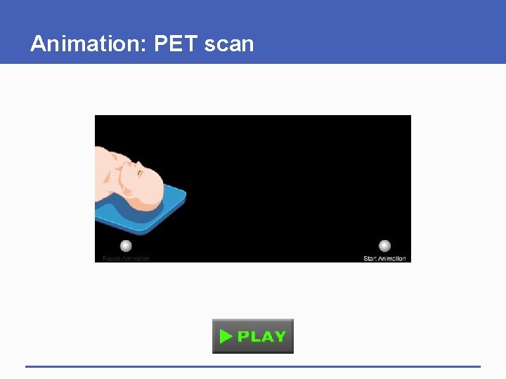 Animation: PET scan 