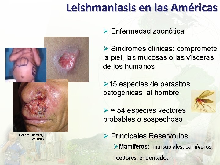 Leishmaniasis en las Américas Ø Enfermedad zoonótica Ø Sindromes clínicas: compromete la piel, las