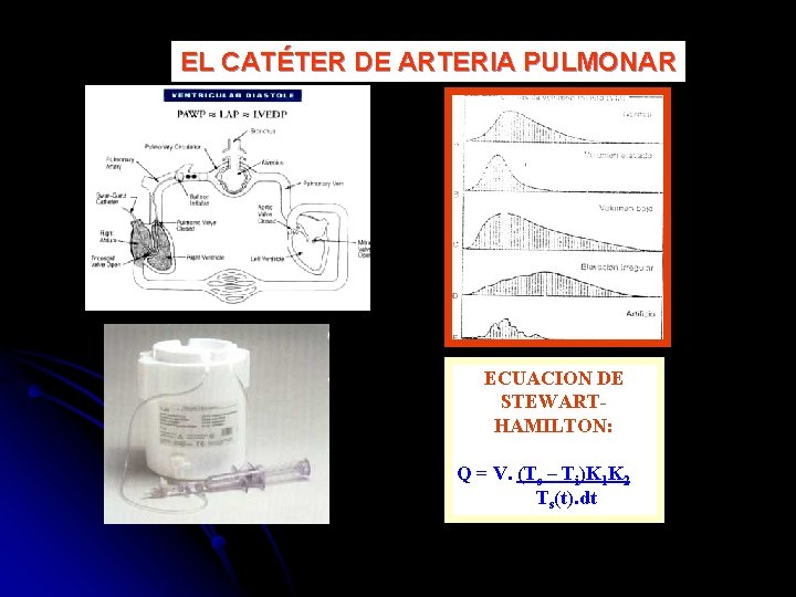 EL CATÉTER DE ARTERIA PULMONAR ECUACION DE STEWARTHAMILTON: Q = V. (Ts – Ti)K