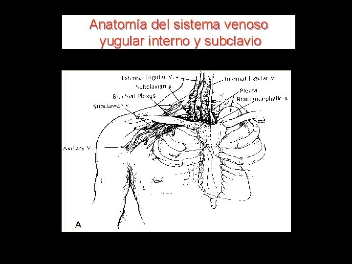 Anatomía del sistema venoso yugular interno y subclavio 