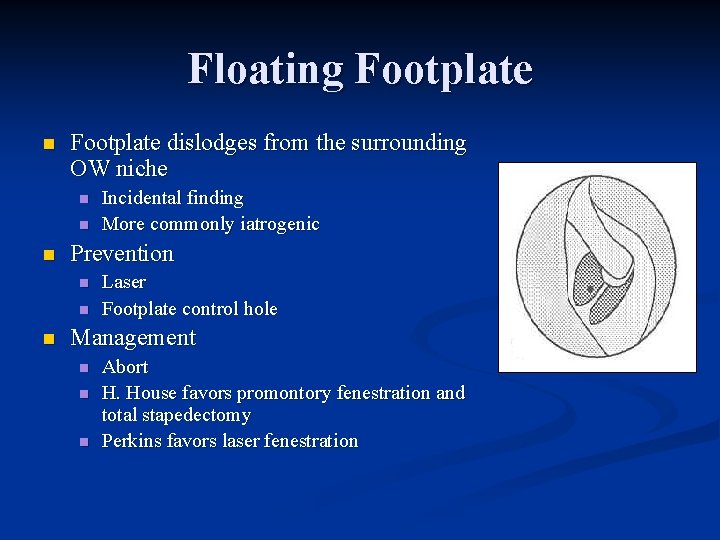 Floating Footplate n Footplate dislodges from the surrounding OW niche n n n Prevention