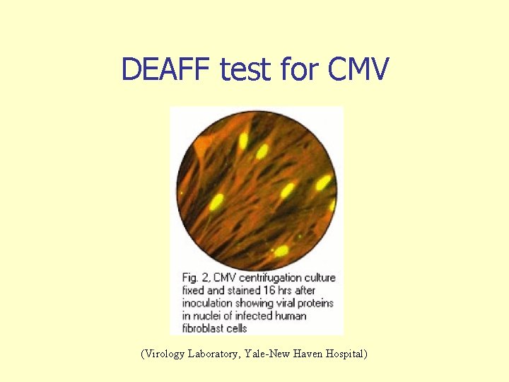 DEAFF test for CMV (Virology Laboratory, Yale-New Haven Hospital) 