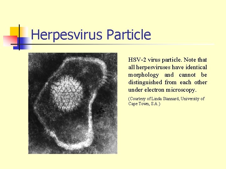 Herpesvirus Particle HSV-2 virus particle. Note that all herpesviruses have identical morphology and cannot