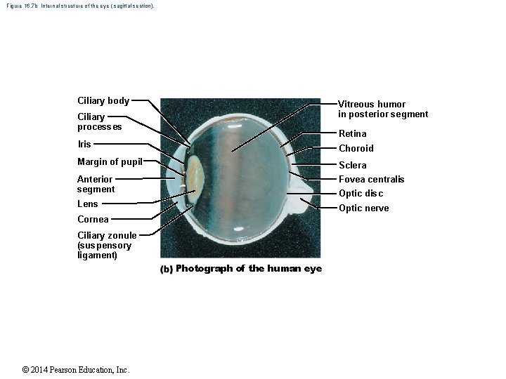 Figure 16. 7 b Internal structure of the eye ( sagittal section). Ciliary body