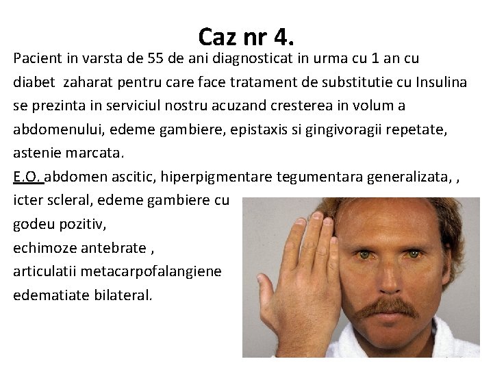 Caz nr 4. Pacient in varsta de 55 de ani diagnosticat in urma cu