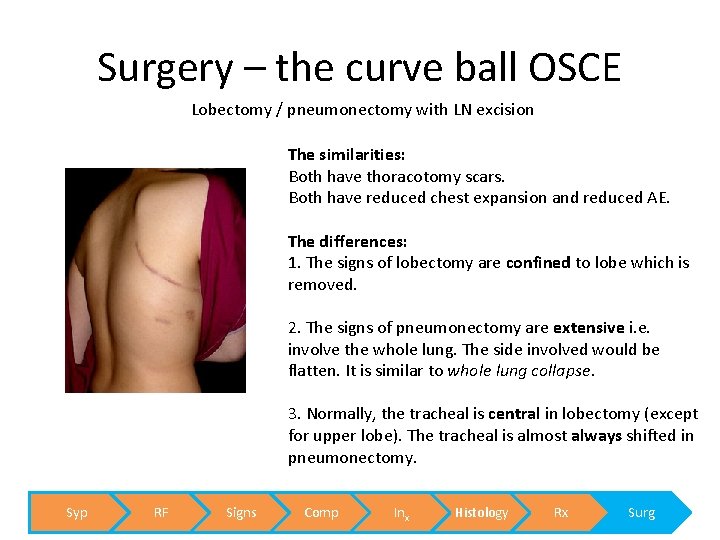 Surgery – the curve ball OSCE Lobectomy / pneumonectomy with LN excision The similarities:
