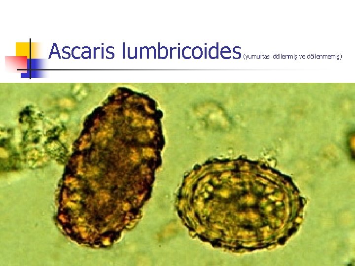 Ascaris lumbricoides (yumurtası döllenmiş ve döllenmemiş) 