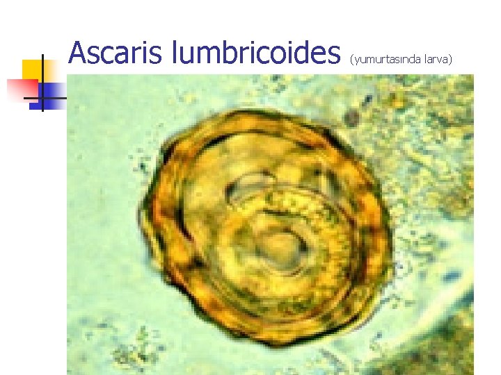 Ascaris lumbricoides (yumurtasında larva) 
