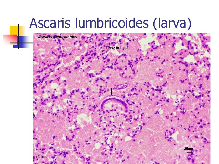 Ascaris lumbricoides (larva) 